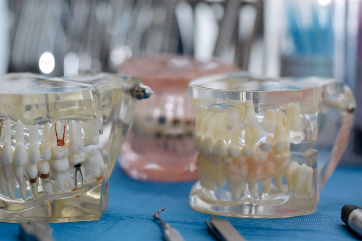 Transparent dental jaw models showing tooth roots set into bone, illustrating the bone volume a dental implant needs to anchor into.