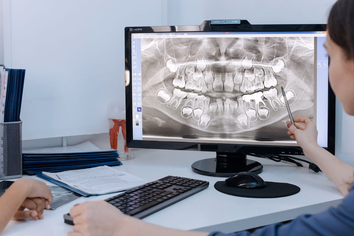 A dentist reviewing a patient's dental X-ray on screen, the assessment that determines whether a case suits aligners or fixed braces.