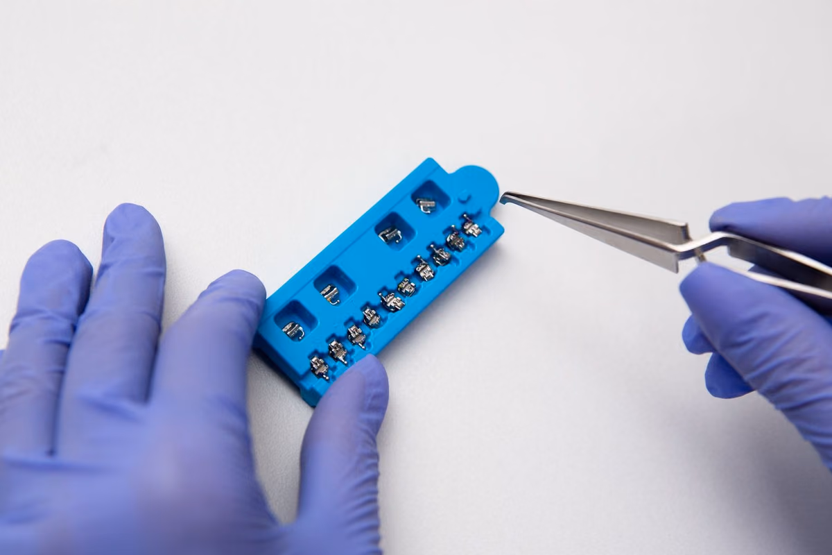 A dentist adjusting fixed orthodontic brackets with precision instruments, the continuous-force approach that suits complex cases well.